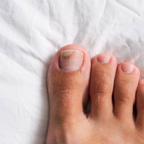 Start with clean, dry toes